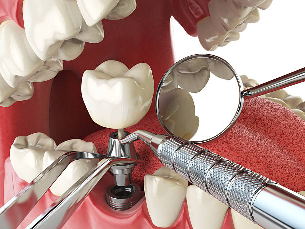 Best Weekend Emergency Dentist in Crestwood, KY